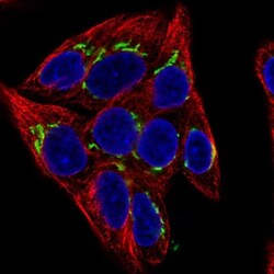 alpha 1 Mannosidase 1A Antibody, Novus Biologicals 25 &mu;L, Unlabeled:Antibodies,